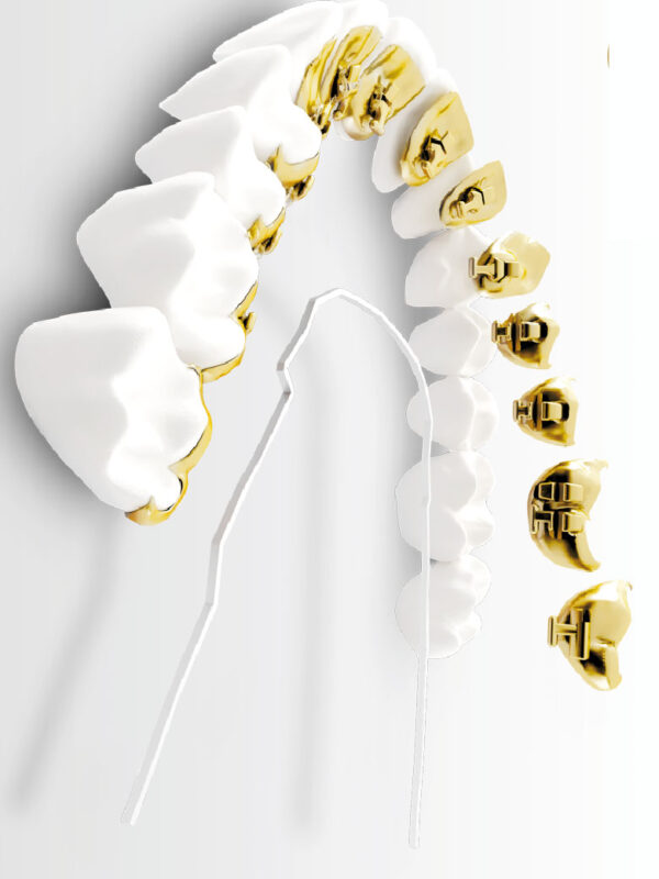 incognito nikos spiropoulos orthodontikos esoterika siderakia