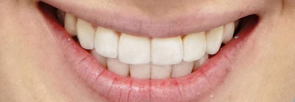 nikos spyropoulos orthodontikos orthodontika apotelesmata