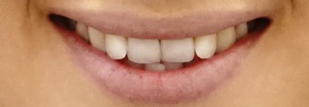 nikos spyropoulos orthodontikos orthodontiki anomalia