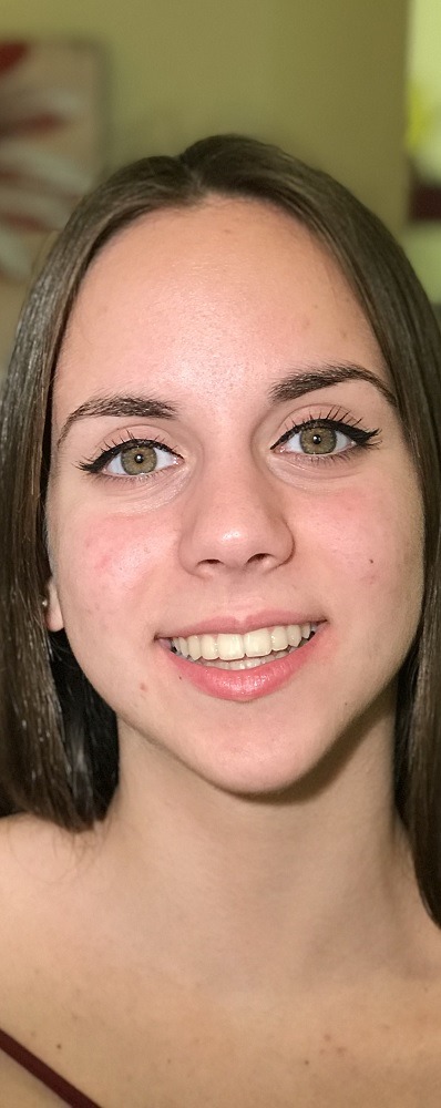 orthodontikos gia efibous peloponnisos