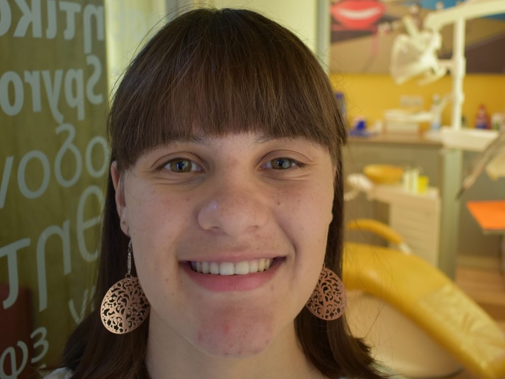 diafana siderakia apotelesma xamogelo nikos spyropoulos orthodontikos